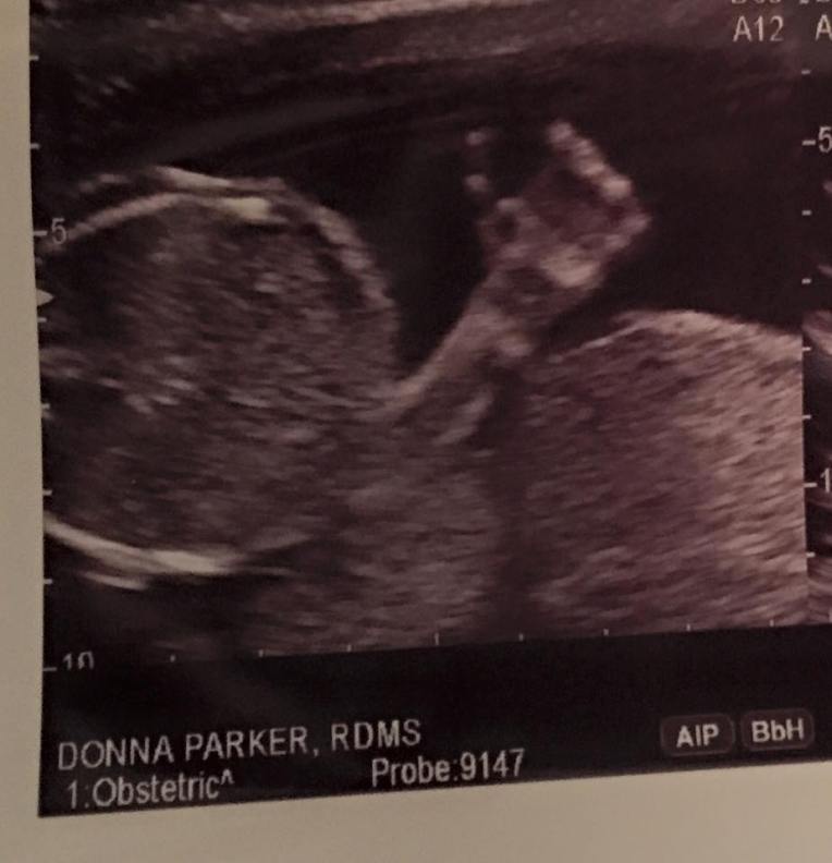 10993484_10203917007501408_835676378667980634_n